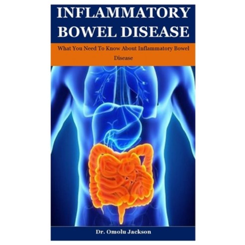 Inflammatory Bowel Disease: What You Need To Know About Inflammatory Bowel Disease Paperback, Independently Published, English, 9798584077419