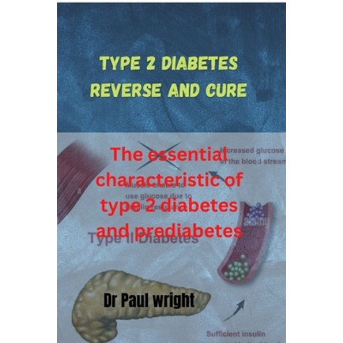 (영문도서) Type 2 diabetes reverse and cure: The essential characteristic of type 2 diabetes and prediab... Paperback, Independently Published, English, 9798360027140