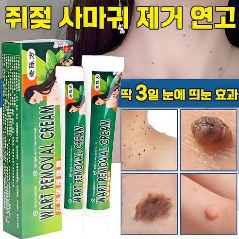 한방 제조의 효능으로 피부 고민을 해결하다 사마귀연고