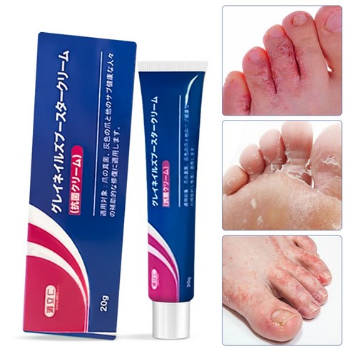 쾌적한 발걸음을 위한 혁신, 일본 발 냄새 제거제 솔루션 라미실연고