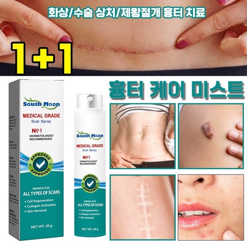 [피부과 전용] 흉터 케어 미스트 수술흉터 화상물집 쌍꺼풀흉터 제왕절개흉터 흉터제거연고 재생크림 과민성 흉터/흉터 증식 여드름흉터, 5개, 20g