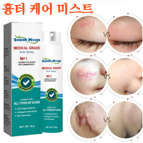 흉터 케어 스프레이 흉터 케어 미스트 수술/화상물집/쌍꺼풀흉터 제거 재생크림, 20g*2