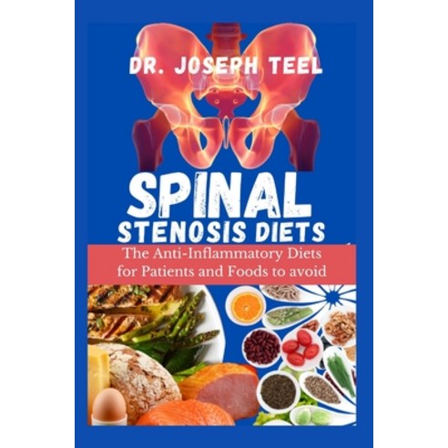 (영문도서) Spinal Stenosis Diets: The Anti-inflammatory Diets for Patients And Foods to Avoid Paperback, Independently Published, English, 9798864019108