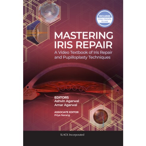 (영문도서) Mastering Iris Repair: A Video Textbook of Iris Repair and Pupilloplasty Techniques Paperback, Slack, English, 9781630917265