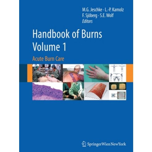 Handbook of Burns Volume 1: Acute Burn Care Paperback, Springer