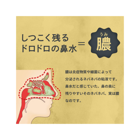치쿠나인 코세척기로 답답한 코, 상쾌하게!
