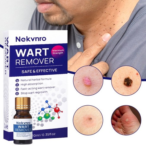 NEKVNRO 편평 제거 피부태그 제거 피부치료 천연 허브 에센스 바디 케어세럼, 1개, 10ml 악센다루티너