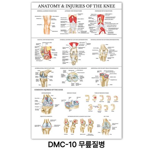 NEW 근육 해부학 포스터, DMC-10 무릎질병