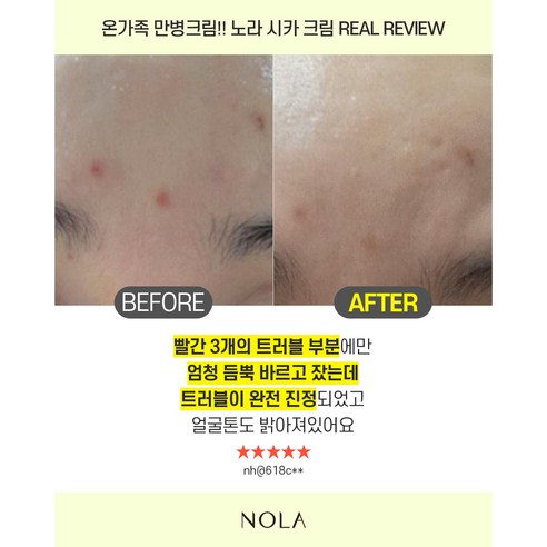 되살아나는 피부, 되찾는 건강한 빛, 노라 리제너레이트 시카크림