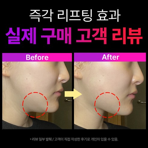 마미케어 브이쎄라로 잃어버린 V라인을 되찾고 자신감을 UP!