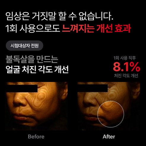 메디테라피 슈마지: 중주파 EMS와 골드실 리프팅으로 되찾는 피부 탄력!
