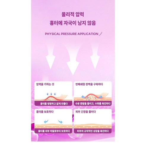 흉터 없는 미래를 위한 Nekvnro 흉터밴드