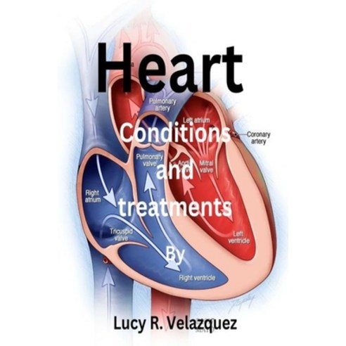 (영문도서) Heart conditions and treatments Paperback, Independently Published, English, 9798865825814