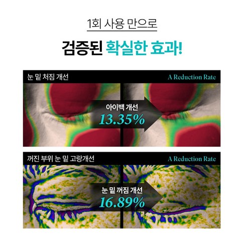 샤르드 아이패치 장단점