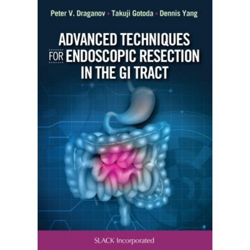 (영문도서) Advanced Techniques for Endoscopic Resection in the GI Tract Hardcover, Slack, English, 9781630914592