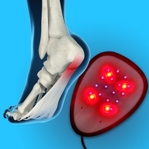 족저근막염 마사지기 관리기 발바닥 발 마사지 근적외선 적외선 원적외선 온열기 찜질기 발목, 1세트