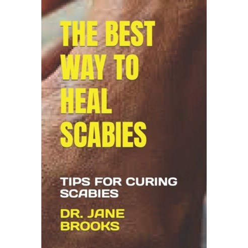 (영문도서) The Best Way to Heal Scabies: Tips for Curing Scabies Paperback, Independently Published, English, 9798376437711