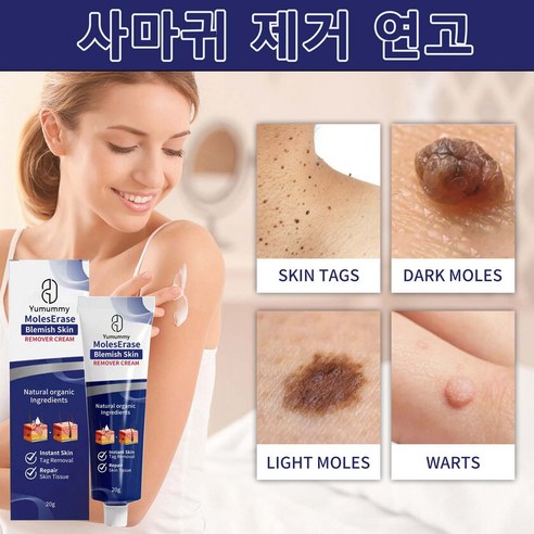Yumummy 1+1얼굴 피부 깨끗해짐 제거 연고 쾌속적 유효 제거 얼굴 목 부분 기미 제거 크림, 4개, 20g