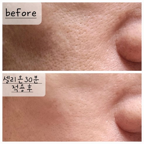 림프순환마스크 3세트: 효과적인 홍조, 열감, 주름, 모공 개선