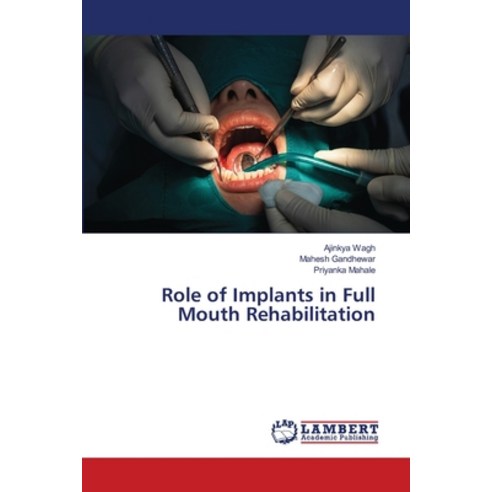 Role of Implants in Full Mouth Rehabilitation Paperback, LAP Lambert Academic Publis..., English, 9786202685962
