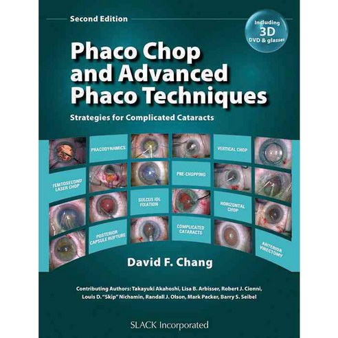 Phaco Chop and Advanced Phaco Techniques: Strategies for Complicated Cataracts, Slack Inc