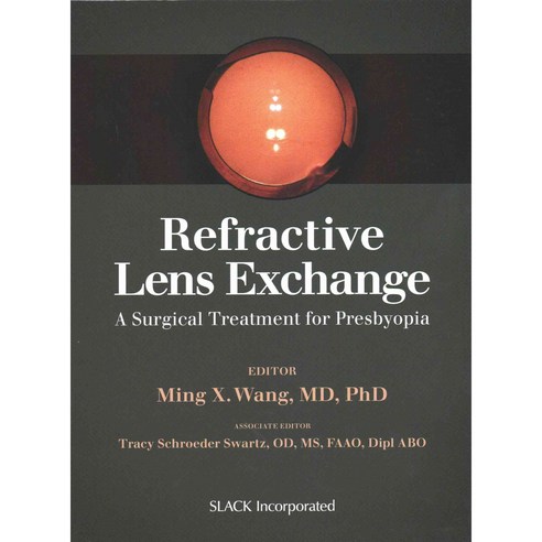 Refractive Lens Exchange: A Surgical Treatment for Presbyopia, Slack Inc