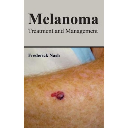 Melanoma: Treatment and Management Hardcover, Foster Academics