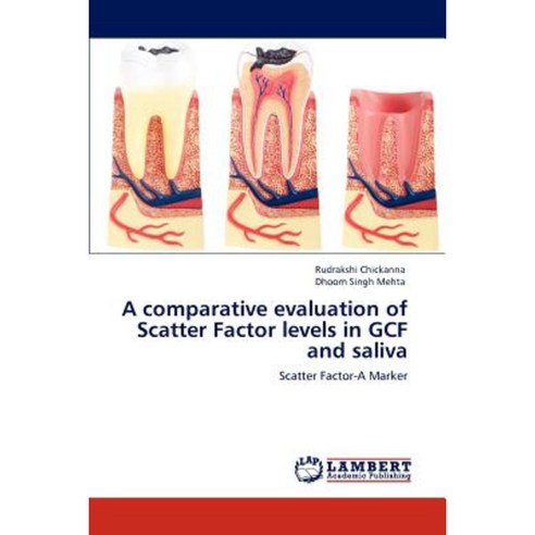 A Comparative Evaluation of Scatter Factor Levels in Gcf and Saliva Paperback, LAP Lambert Academic Publishing