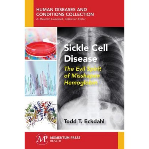 Sickle Cell Disease: The Evil Spirit of Misshapen Hemoglobin Paperback, Momentum Press