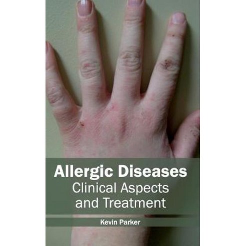 Allergic Diseases: Clinical Aspects and Treatment Hardcover, Hayle Medical