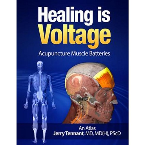 Healing Is Voltage: Acupuncture Muscle Batteries Paperback, Createspace Independent Publishing Platform