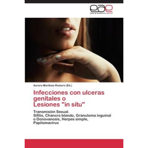 Infecciones Con Ulceras Genitales O Lesiones in Situ Paperback, Eae Editorial Academia Espanola