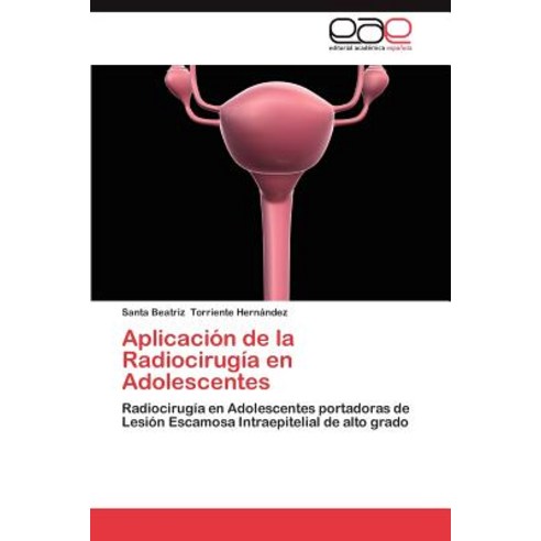 Aplicacion de La Radiocirugia En Adolescentes Paperback, Eae Editorial Academia Espanola