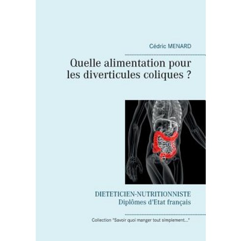 Quelle Alimentation Pour Les Diverticules Coliques Paperback, Books on Demand
