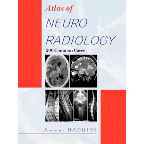 Atlas of Neuroradiology: 200 Common Cases Paperback, Trafford Publishing