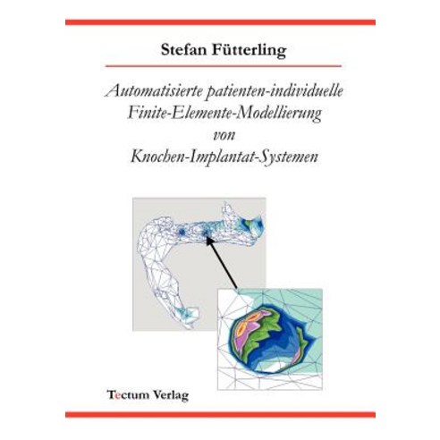 Automatisierte Patienten-Individuelle Finite-Elemente-Modellierung Von Knochen-Implantat-Systemen Paperback, Tectum - Der Wissenschaftsverlag