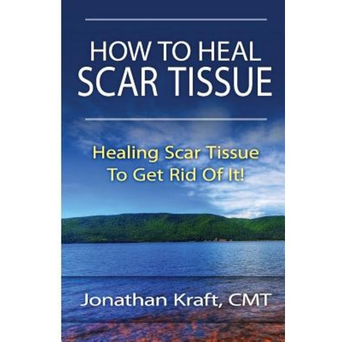 How to Heal Scar Tissue: How to Heal Your Own Scar Tissue and Get Rid of It! Paperback, Createspace
