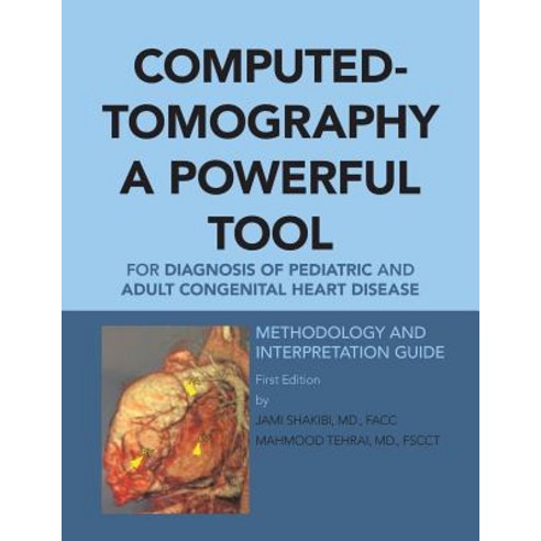 Computed-Tomography a Powerful Tool for Diagnosis of Pediatric and Adult Congenital Heart Disease: Met..., Authorhouse