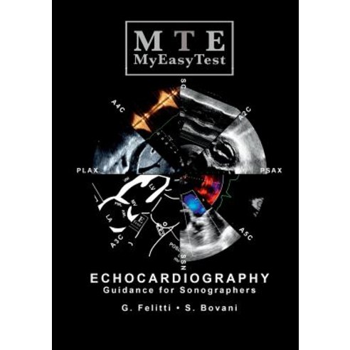 Echocardiography - Myeasytest Paperback, Lulu.com