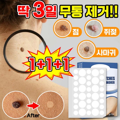 [빠른배송] 피부 제거 패치 얼굴 바디 피부 치료 라벨 스텔스 포장증정, 143매입, 3개