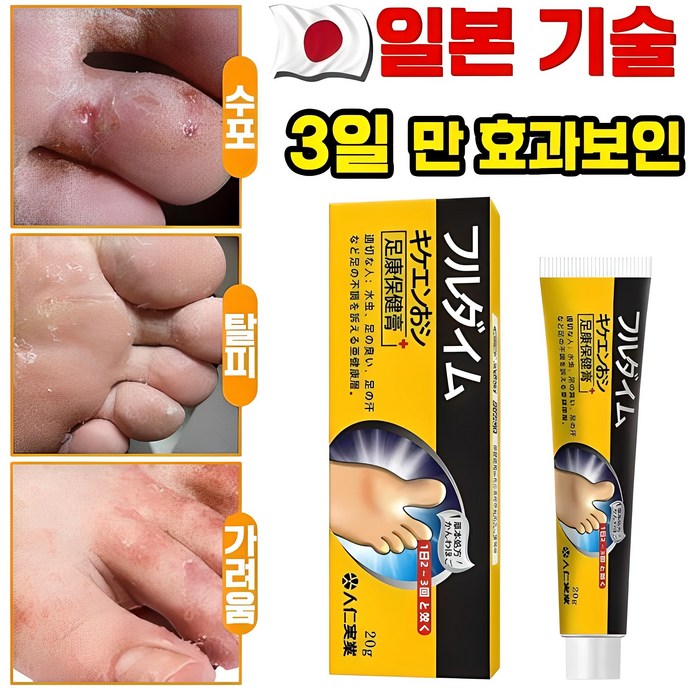 [국내배송] 일본 발 연고 발냄새 제거 발바닥 발가락 가려움 완화 연고 포장증정, 1개, 20g, 1개입 대표 이미지 - 주부습진 연고 추천