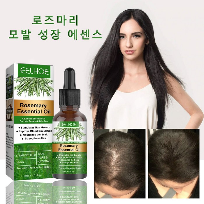 로즈마리 에션설 오일 가려움 완화 탈모예방 모낭 모발 성장 도움 머리가락 강화 두피영양 공급, 1개 대표 이미지 - 로즈마리 오일 추천