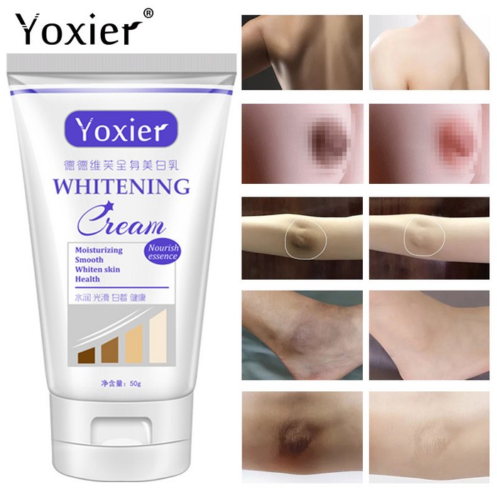 Yoxier 화이트닝 크림 개선 팔 겨드랑이 발목 팔꿈치 무릎 젖꼭지 개인 부품 Whitenings Body Dull Brighten Bodys Care, 한 개 대표 이미지 - 겨드랑이 미백 추천