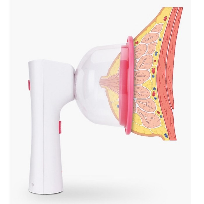 전문 전기 유방 확대 마사지 장치 진공 가슴 펌프 가슴 처짐 흡입 컵, 큰 싱글 컵 대표 이미지 - 가슴 마사지기 추천