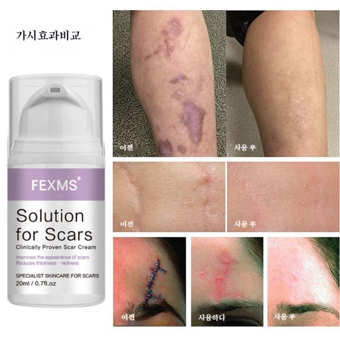 흉터제거연고 화상 상처 흉터 수술 상처 피부 흉터 치료, 20ml, 1개 대표 이미지 - 수술 흉터 제거 추천