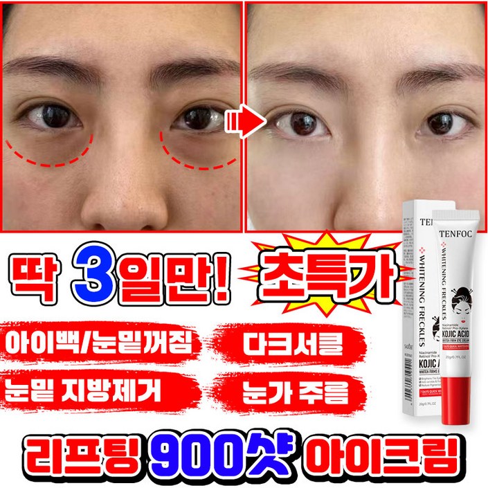 빠른효과 11122 유쎄라블 리프팅 900샷 아이크림 눈 밑 지방 볼륨 개선 아이팔트 아이백 크림 눈밑 지방제거 눈가주름 다크서클 눈밑꺼짐 제거 크림 아이케어