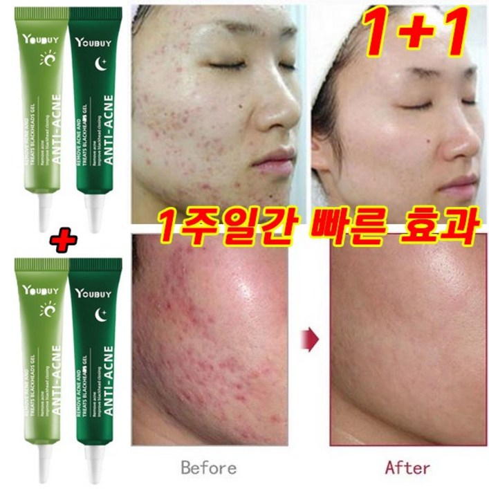 [당일배송] 여드름 연고 여드름 흉터 치료 연고 여드름 흉터 리페어 크림