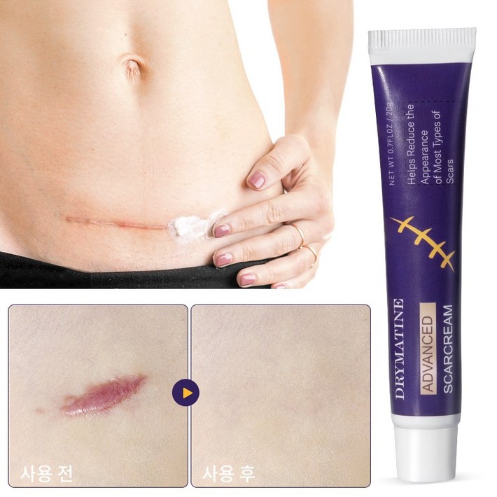 당일배송 DRYMATINE 흉터연고 흉터제거연고 재생크림 상처흉터연고 여드름흉터 수술흉터 화상물집 흉터제거연고