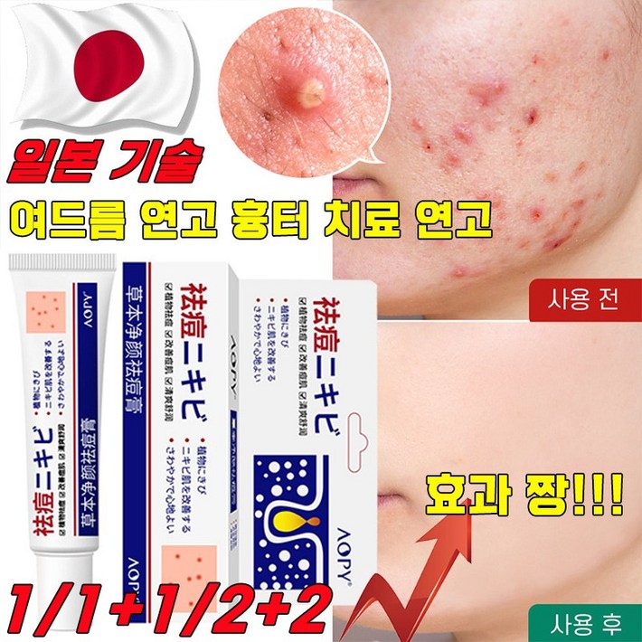 [국내배송] 일본 여드름 연고 흉터 치료 연고 청소년 피부 화농성 여드름 제거 리페어 연고 모공 진정 피지케어 크림