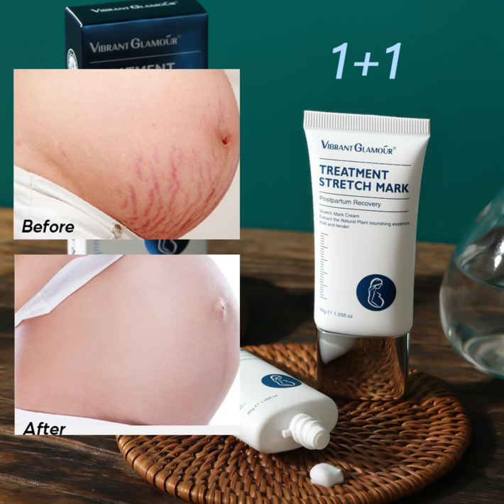 스트레치 마크 크림 튼살크림 임산부 피부 집중 케어, 2개, 30g 스트레치 마크 크림 튼살크림 임산부 피부 집중 케어, 2개, 30g